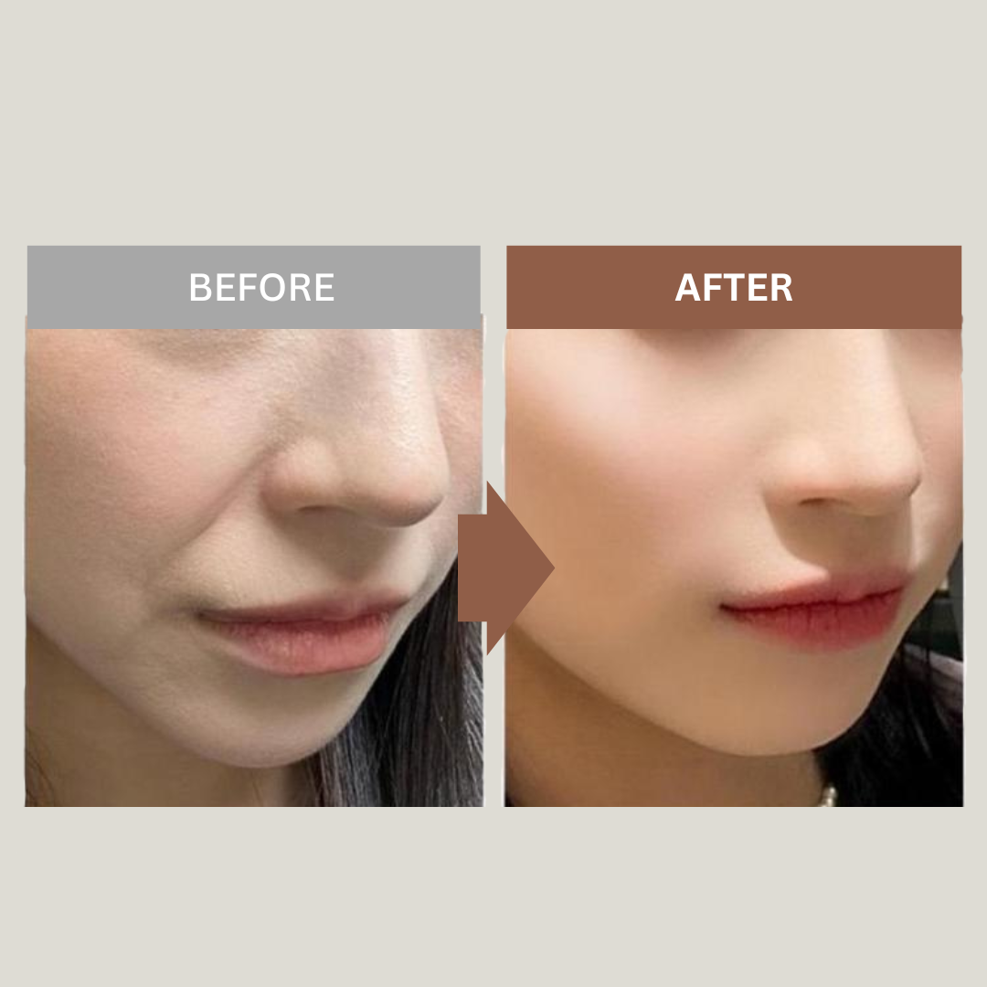 Korean Silk Youth Lifting Peptides