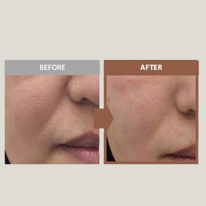 Korean Silk Youth Lifting Peptides